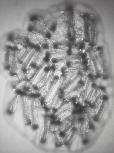 "Virus: non - specifica mammalianencephalitis paramyxovirus (MEP), family: Paramyxoviridae" from series "Pandemia", Aleksandra Ska